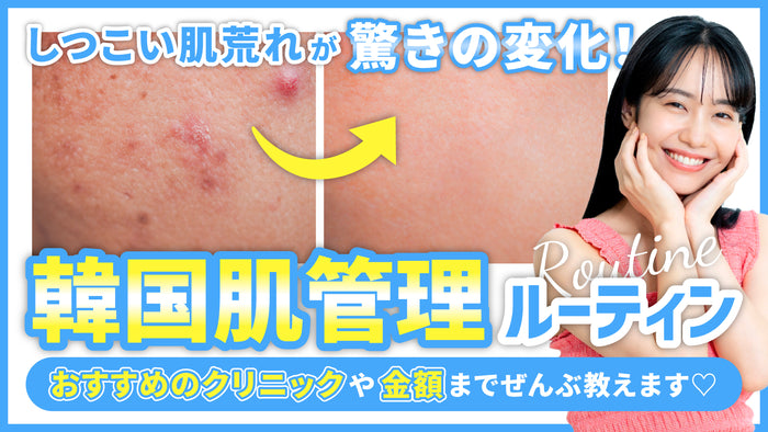 変化 ルーティン 開設 サムネイルテンプレート